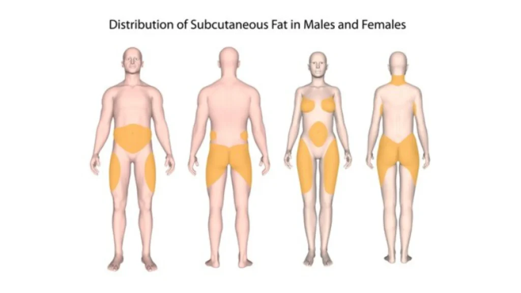 Illustration showing the distribution of subcutaneous fat in males and females, with males typically storing fat in the abdominal area and females storing fat in the hips, thighs, and buttocks